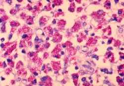 Mycobacterium avium (imagem) e Mycobacterium abscessus) são espécies de micobactérias que exigem tratamentos longos, demorados e que nem sempre funcionam (Wikipedia)